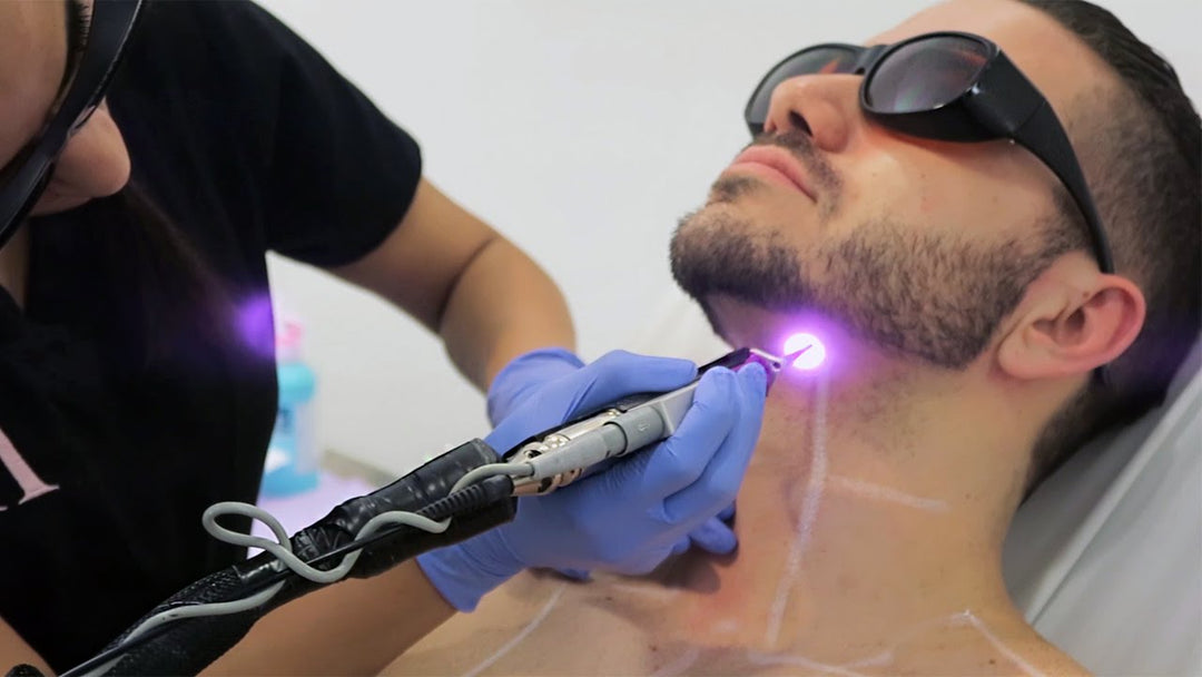 Things To Consider Before Getting Laser Hair Removal Treatment