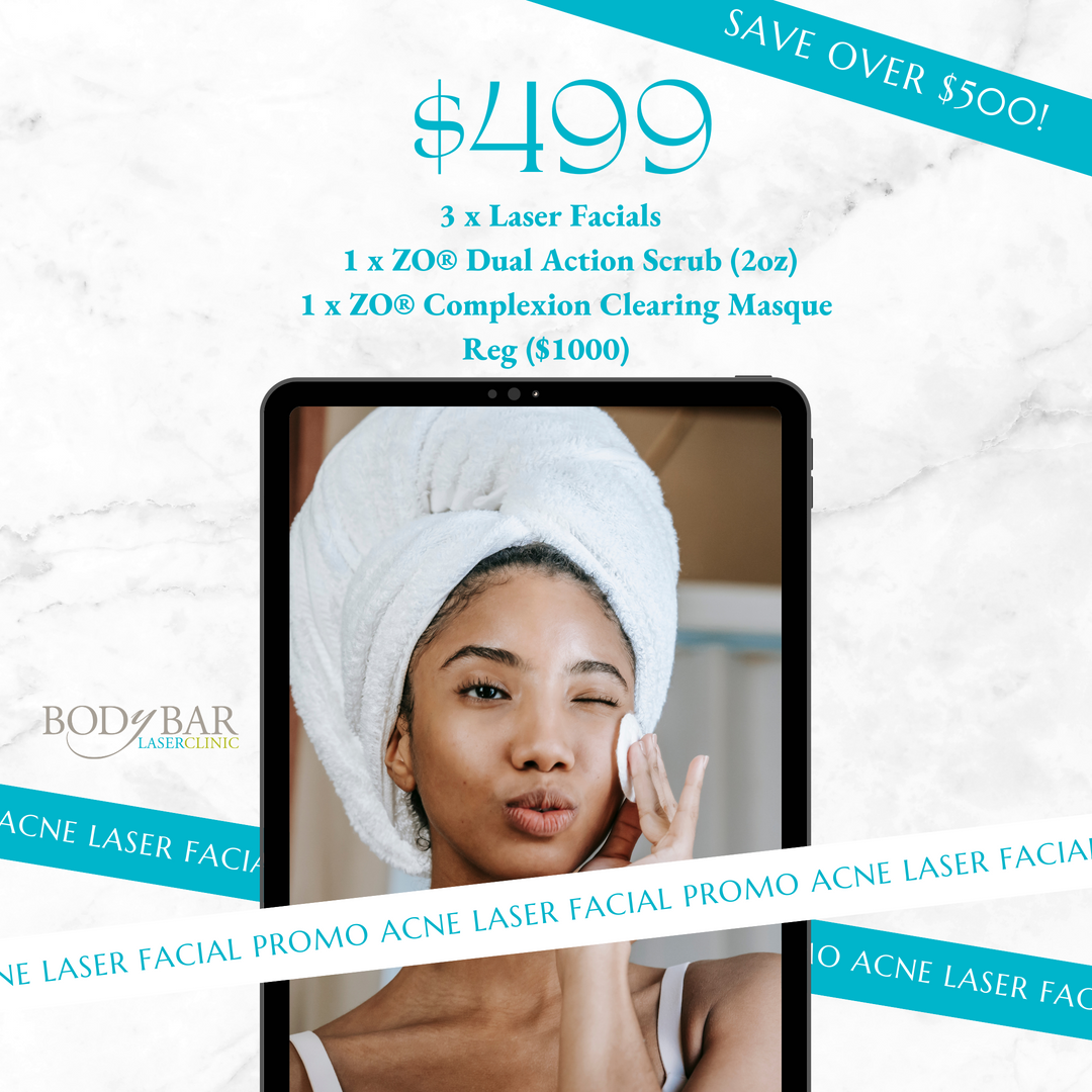 Acne Laser Facial Promotion