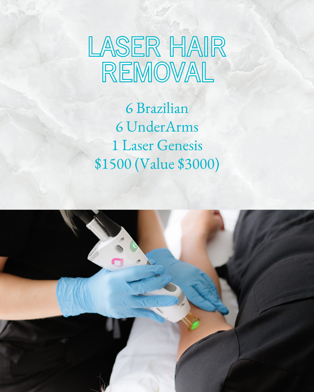 Summer Sale - Laser Hair Removal
