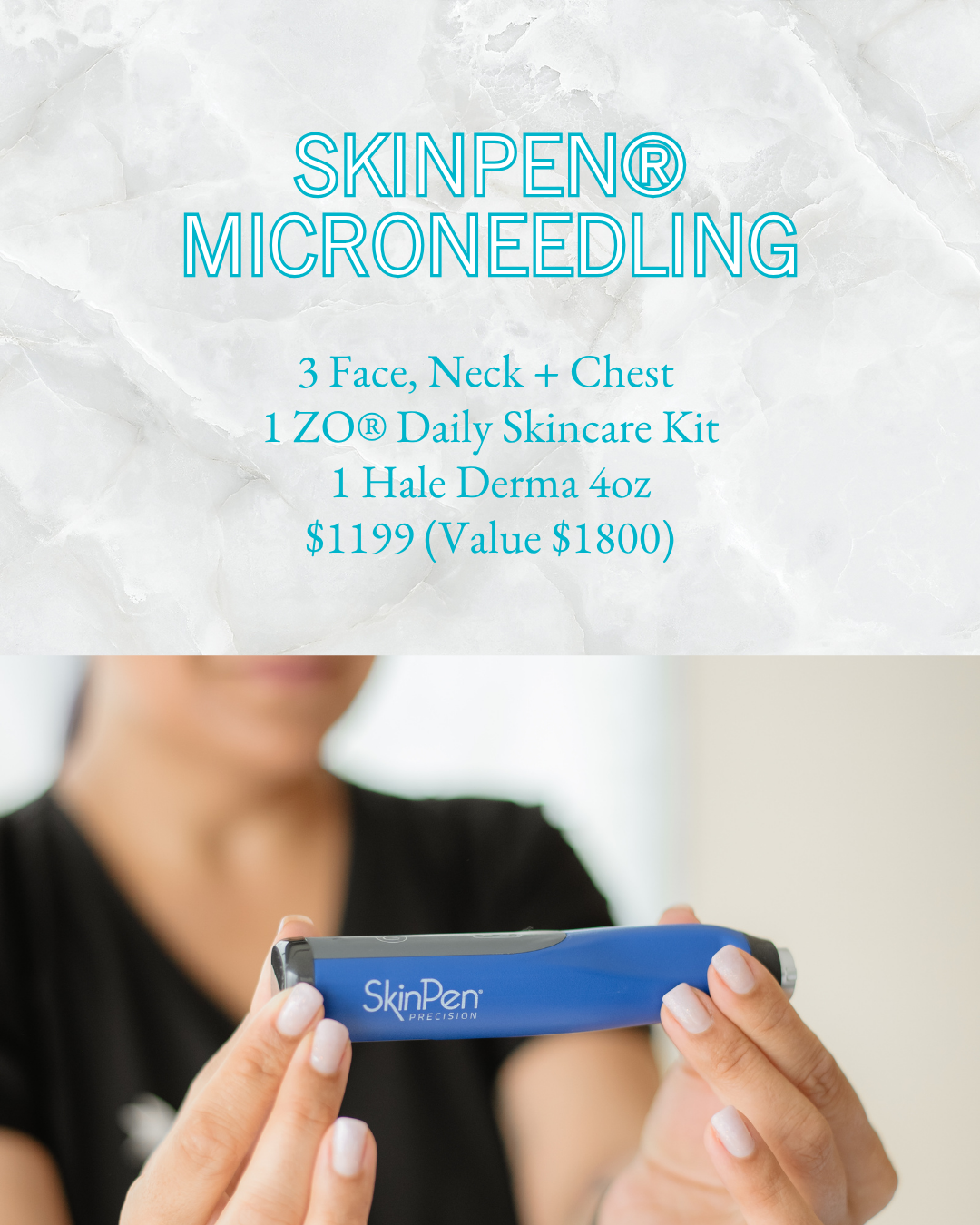 Summer Sale - SkinPen Microneedling